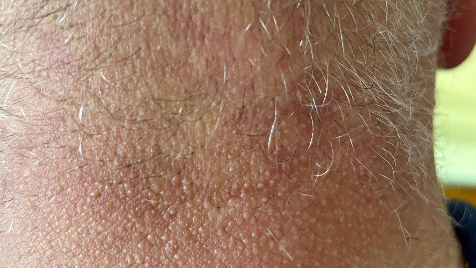 La influencia de la primavera en nuestro cabello La influencia de la primavera en nuestro cabello
