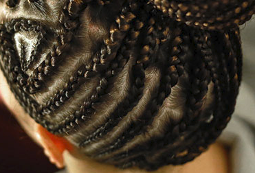 alopecia traumática alopecia traumática