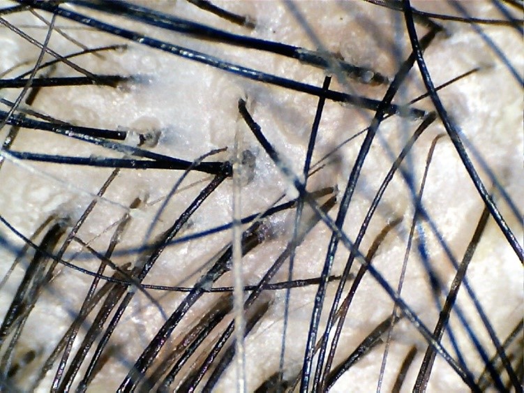 Refuerza el cabello ante la caída estacional Refuerza el cabello ante la caída estacional